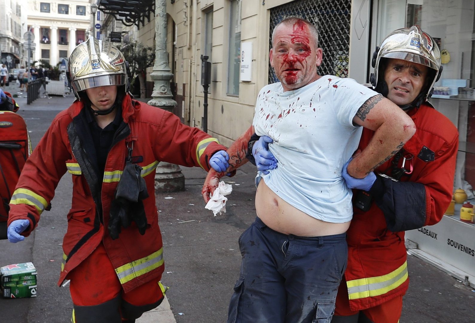 A man is taken away by emergency service workers after he was injured in clashes in downtown Marseille, France, Saturday, June 11, 2016. Riot police have thrown tear gas canisters at soccer fans Saturday in Marseille's Old Port in a third straight day of violence in the city.  (AP Photo/Darko Bandic)